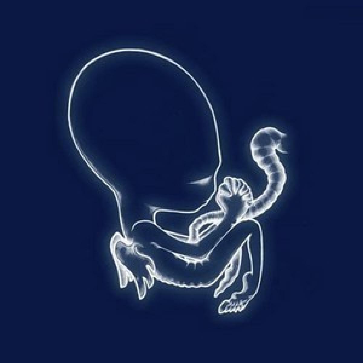SIGUR RÓS 
