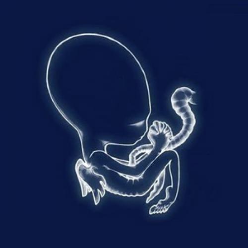 SIGUR RÓS 
