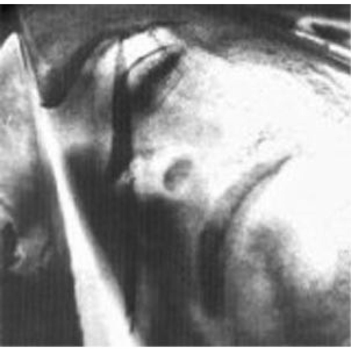 Landfill "Assassins" CD