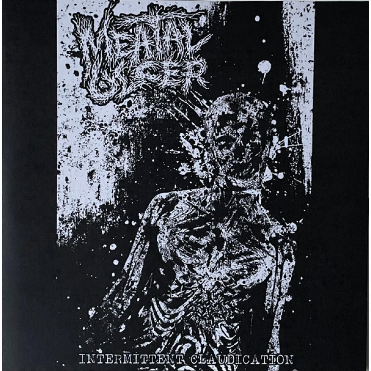 Meatal Ulcer "Intermittent Claudication" 7"