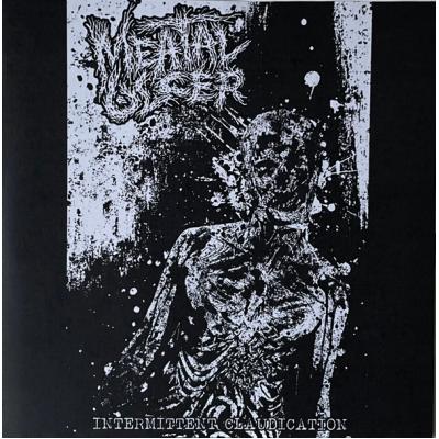 Meatal Ulcer "Intermittent Claudication" 7"