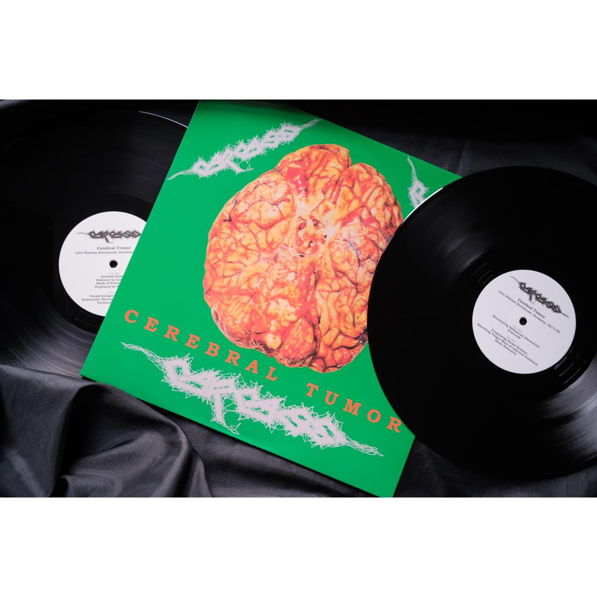 Carcass "Brain-washing At Live Station Dortmund, Germany 30/7/90" 2LP